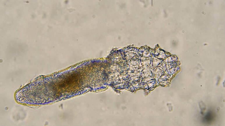 demodex mite under microscope